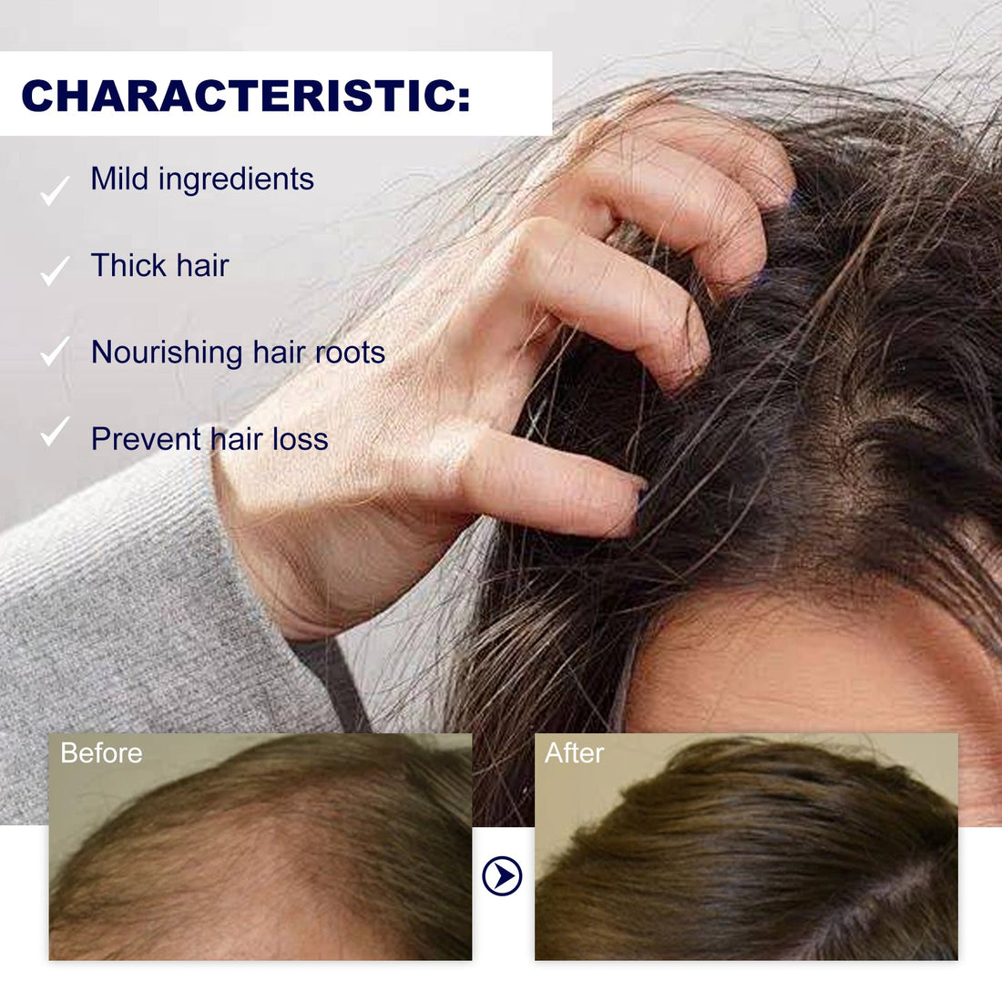 Hair Treatment Roller Root Repair Care