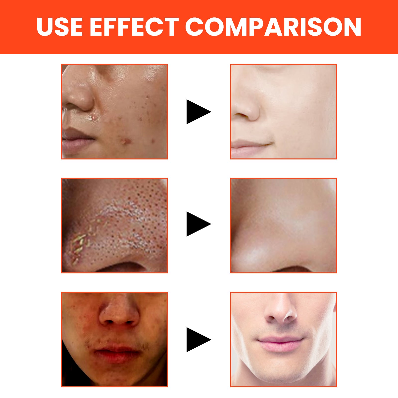 Men’s Volcanic Face Wash Deep Oil Control