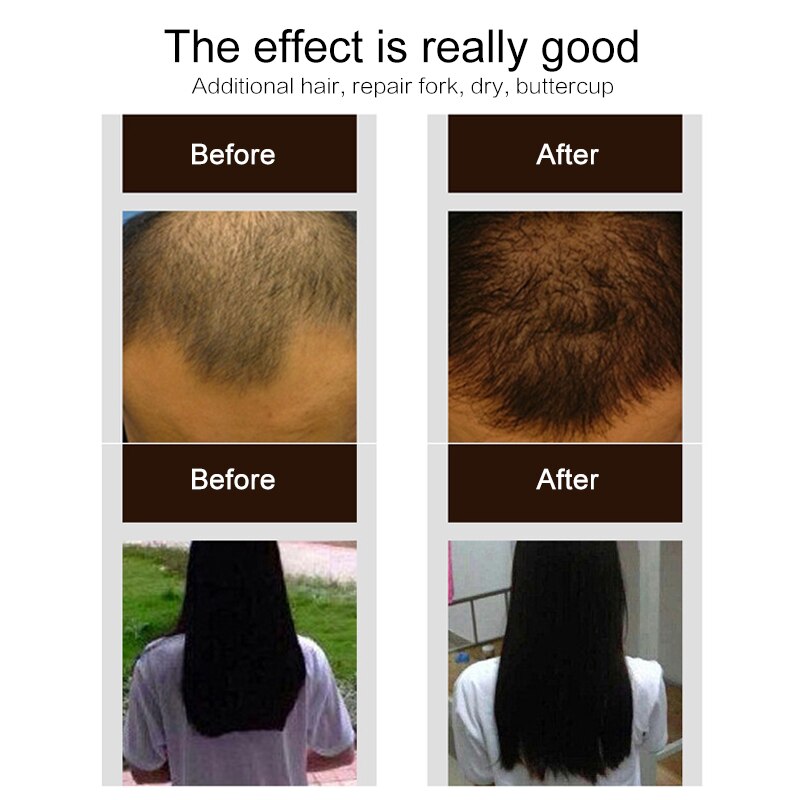 Ginger Hair Growth Spray Root Nourishing Treatment