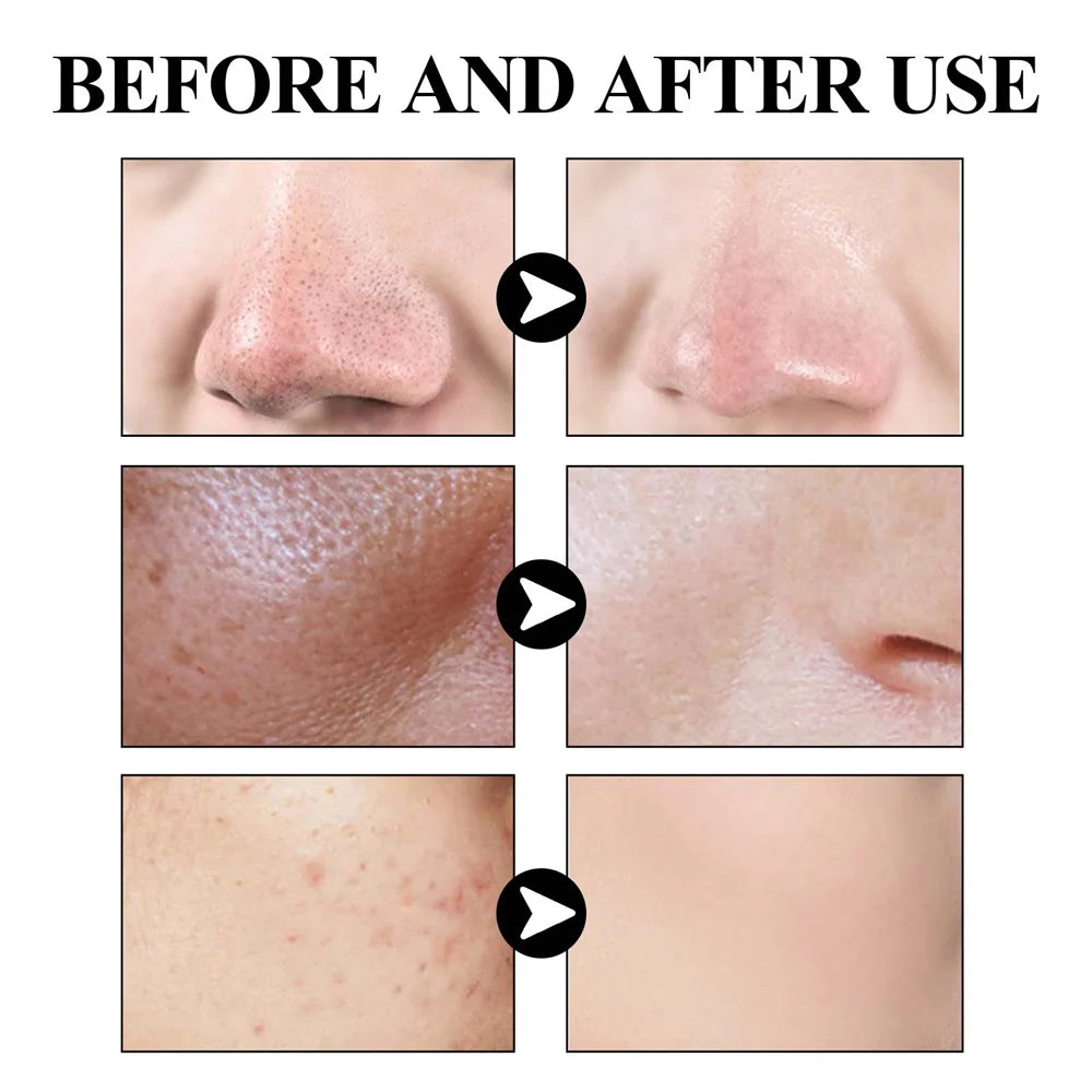 West & Month Blackhead Mud Mask Pore Cleanser