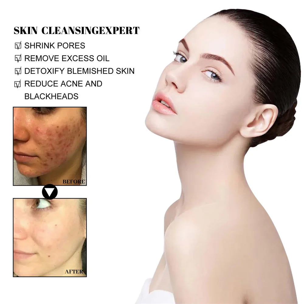 West & Month Blackhead Mud Mask Pore Cleanser