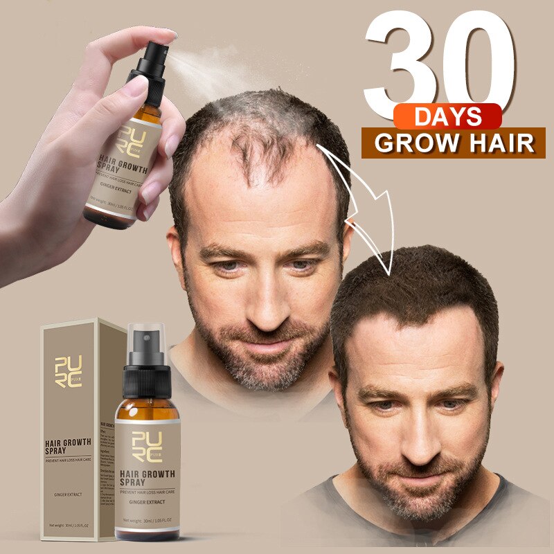 Ginger Hair Growth Spray Root Nourishing Treatment