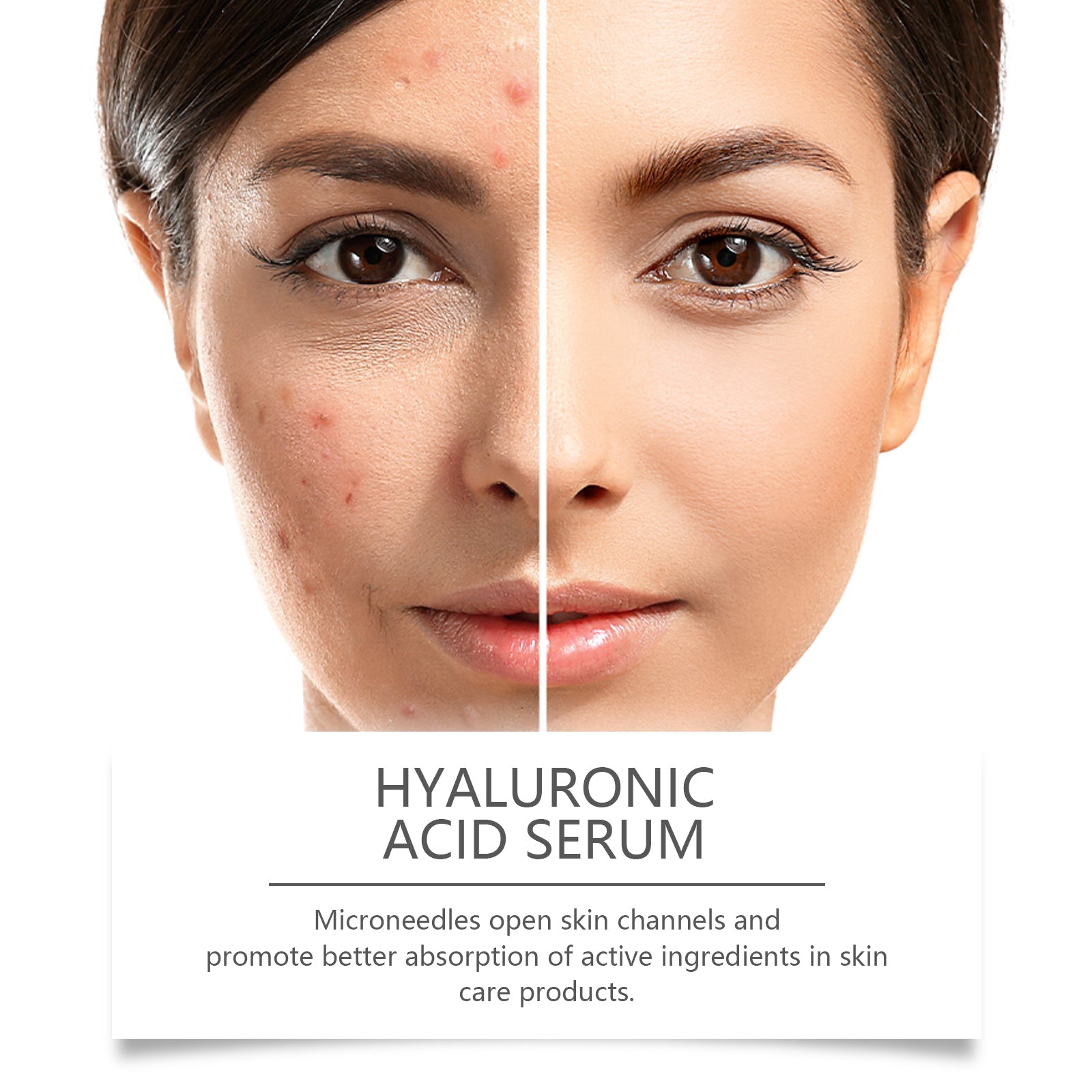 Hyaluronic Acid Face Serum Hydrating Pore Refining Skincare Treatment