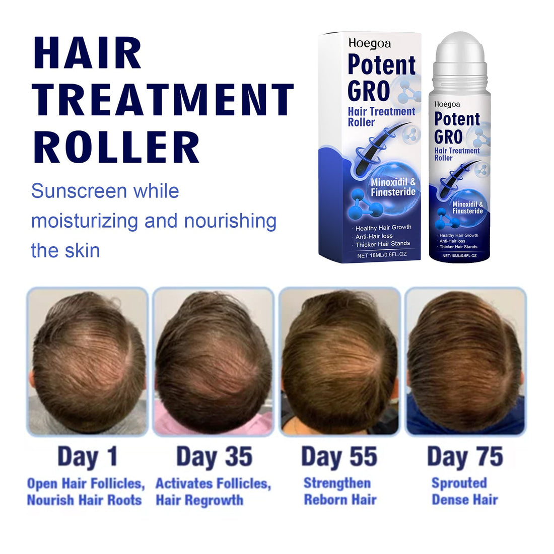 Hair Treatment Roller Root Repair Care