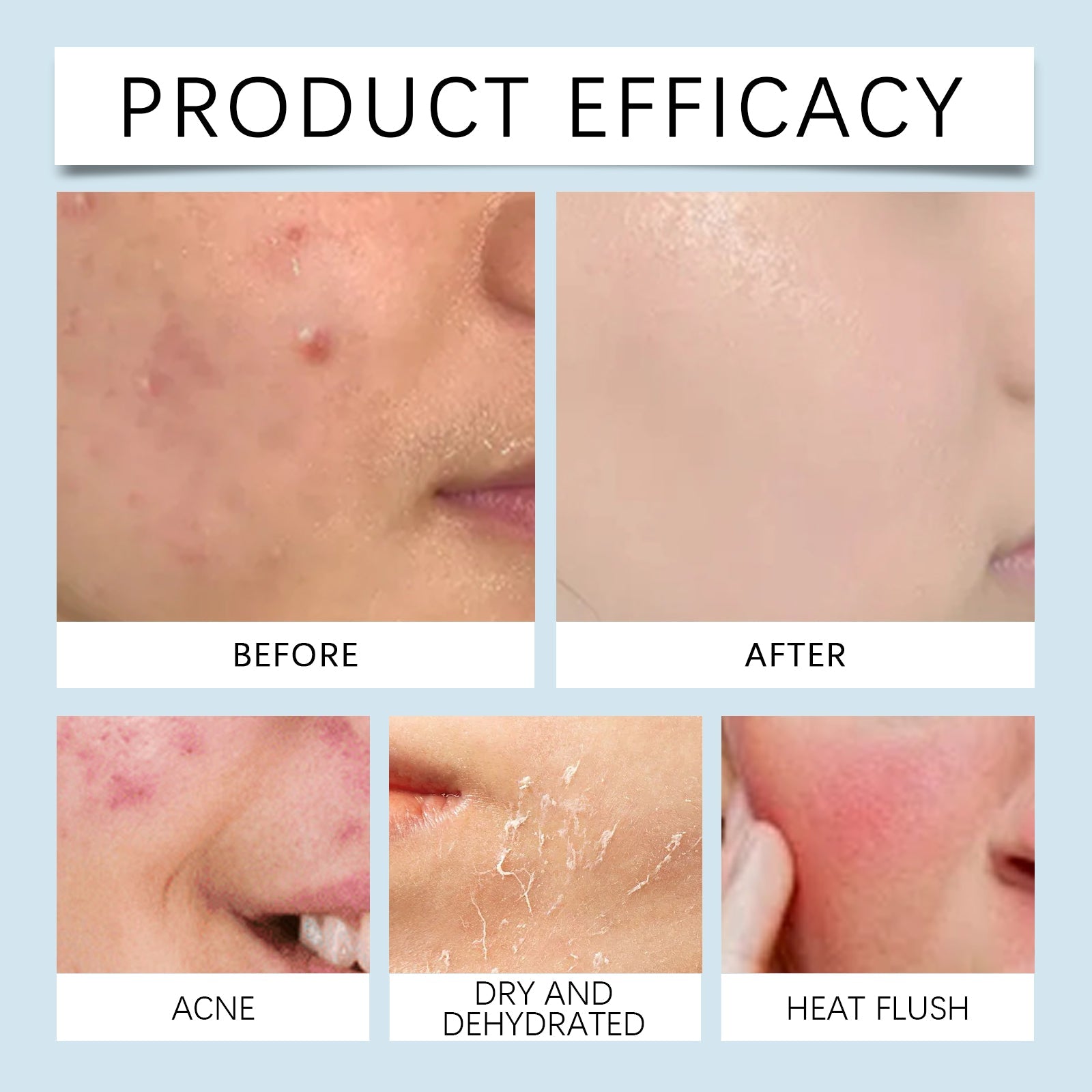 Hyaluronic Acid Face Serum Hydrating Pore Refining Skincare Treatment
