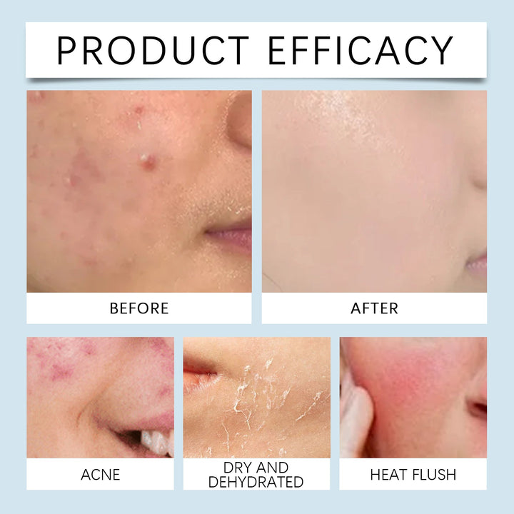 Hyaluronic Acid Face Serum Hydrating Pore Refining Skincare Treatment