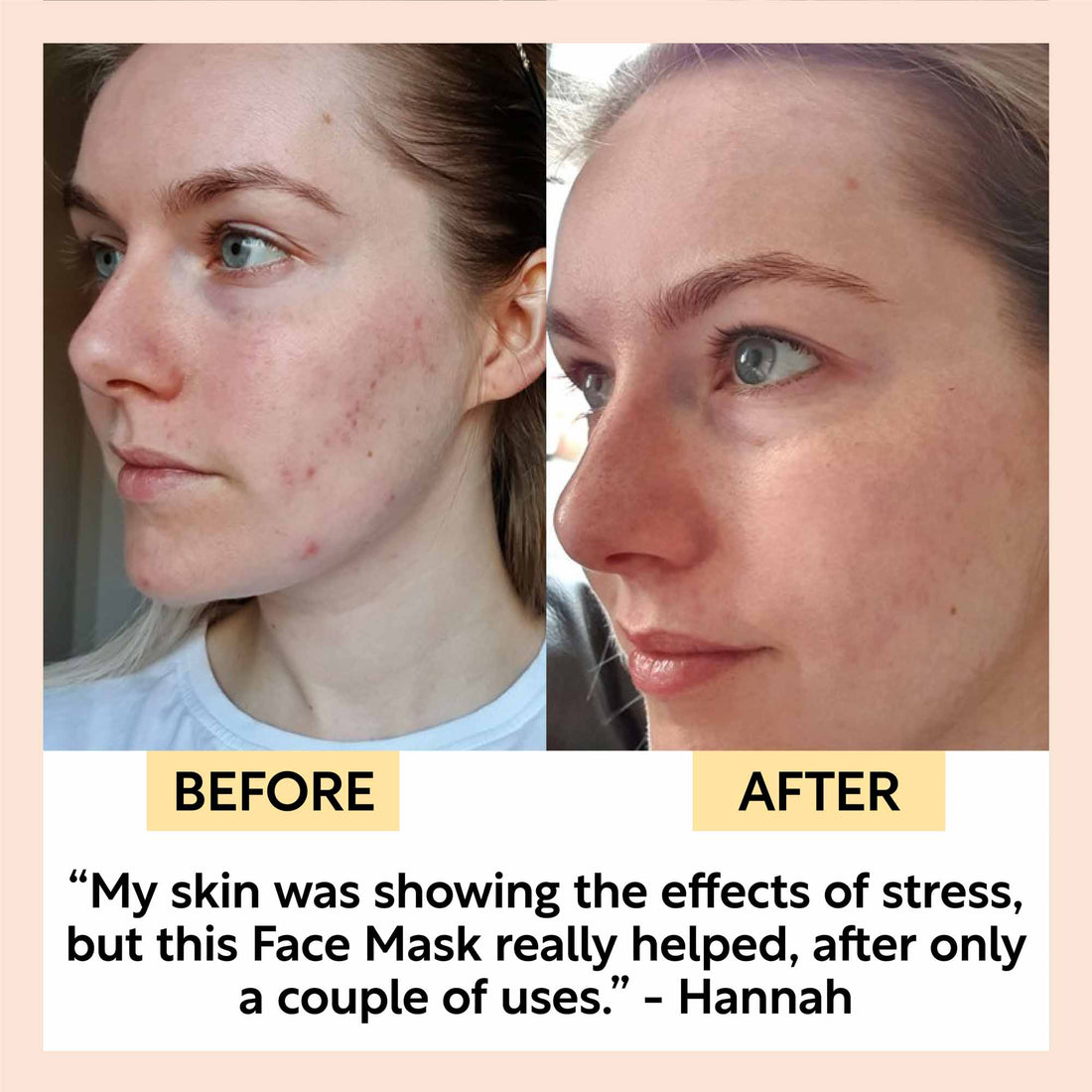 Kaolin Clay Face Mask Deep Cleansing Skincare Treatment