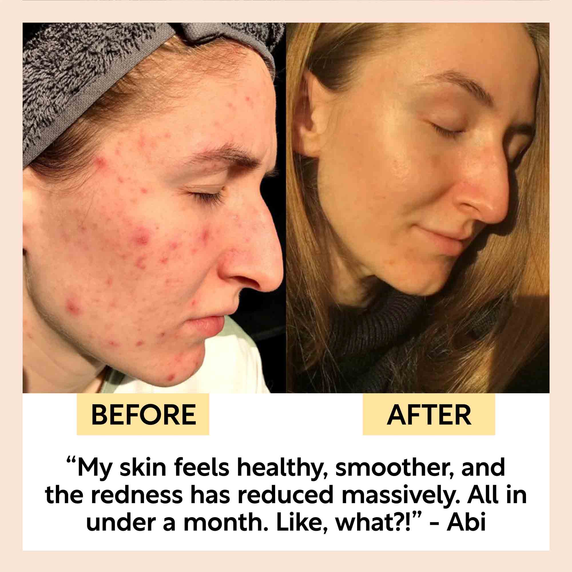 Kaolin Clay Face Mask Deep Cleansing Skincare Treatment