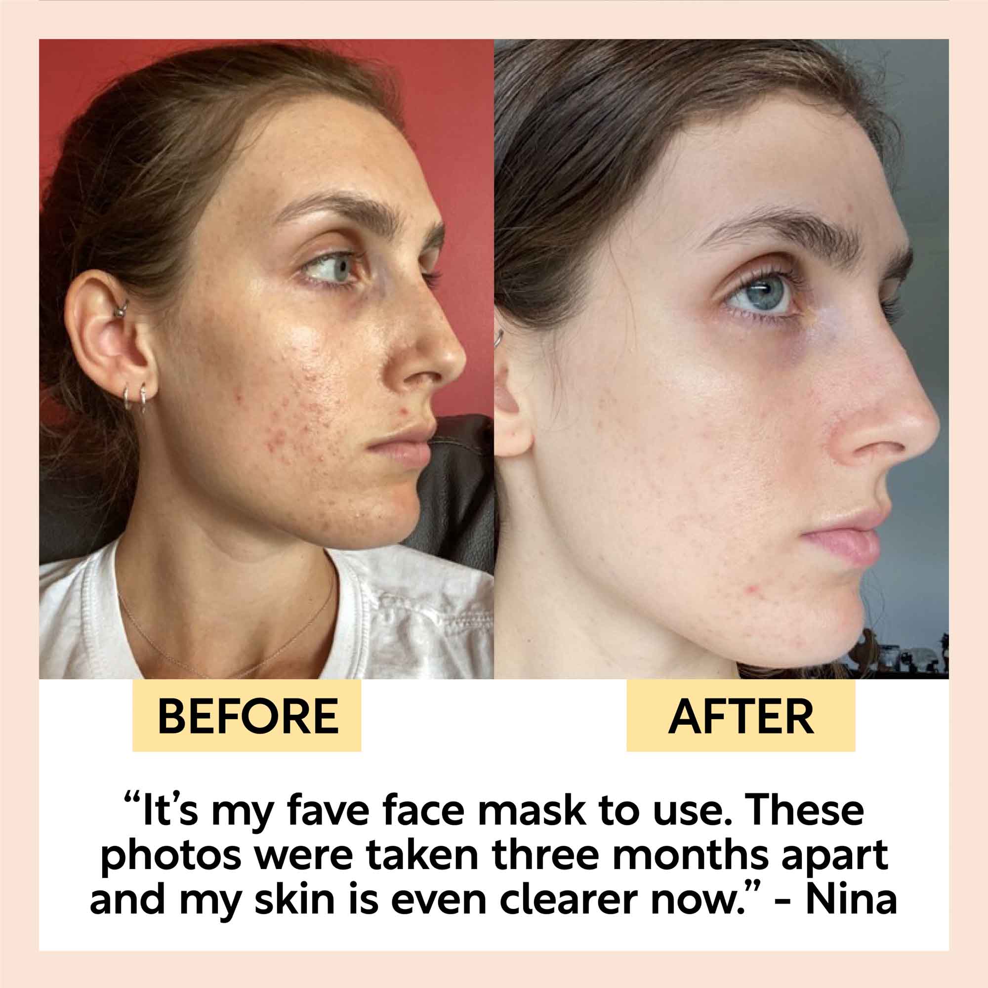 Kaolin Clay Face Mask Deep Cleansing Skincare Treatment
