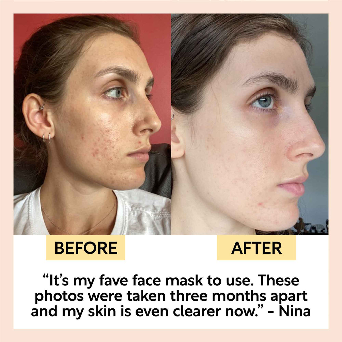 Kaolin Clay Face Mask Deep Cleansing Skincare Treatment