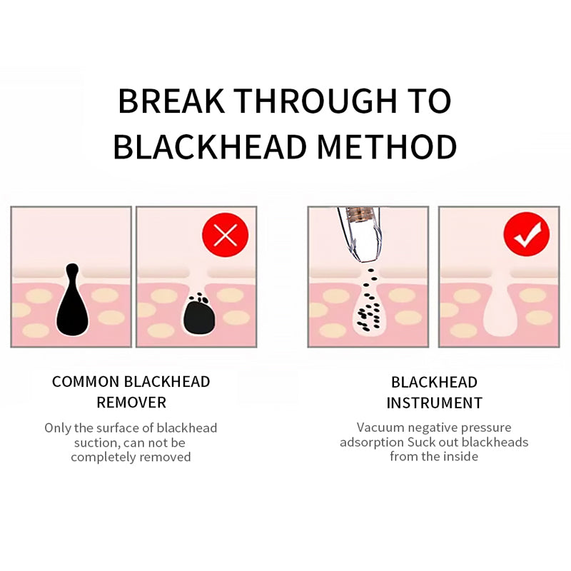 Blackhead Remover Vacuum Deep Pore Facial Cleaner Device